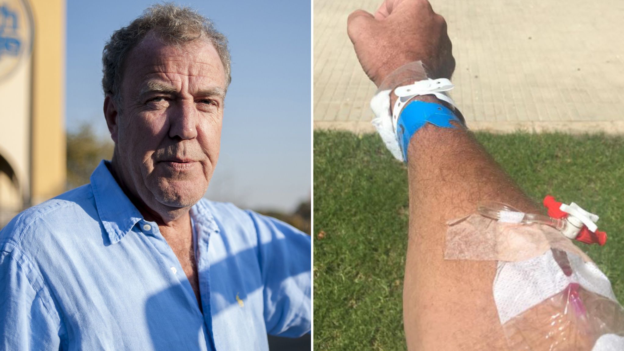 Jeremy Clarkson Admitted To Hospital With Pneumonia While On Holiday In Majorca Ents And Arts