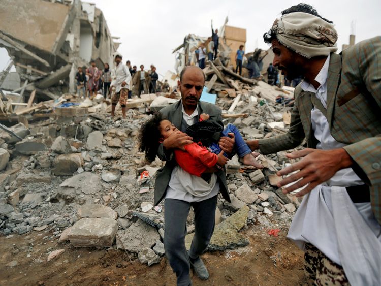 
YEMEN-SECURITY/AIRSTRIKERTX3DFFQ26 Aug. 2017Sanaa, YemenButhaina Muhammad Mansour, believed to be four or five, sits on a bed at a hospital after she survived a Saudi-led air strike that killed eight of her family members in Sanaa. REUTERS/Khaled Abdullah