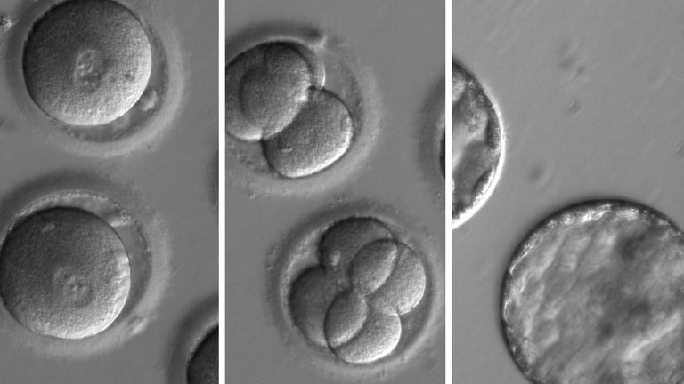 A sequence of images showing the development of embryos after the procedure. Pic: OHSU