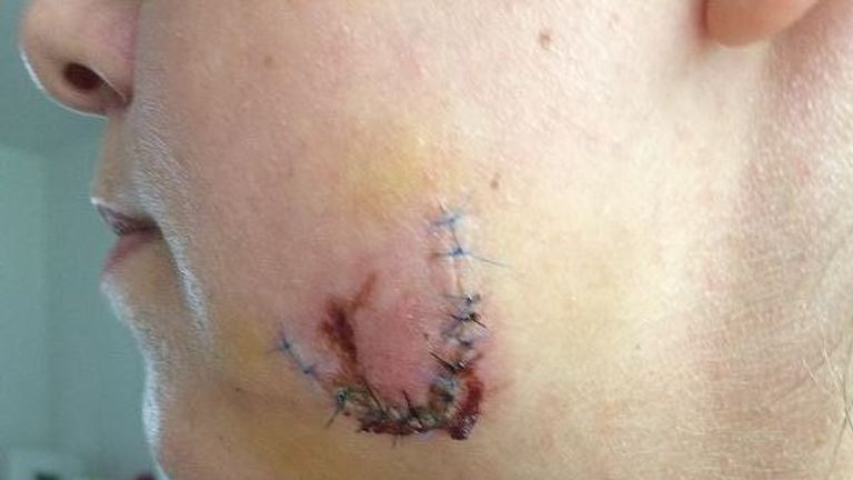 The Met Police released this image of the woman's face after the assault 