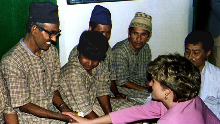 Diana touches a leprosy sufferer during a visit to Nepal