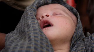 This two-day old Rohingya baby is desperately ill 