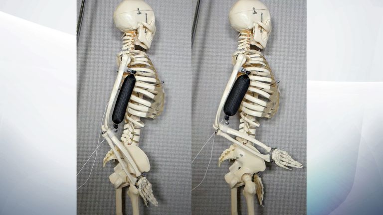 Artificial muscle in use as a bicep lifts a skeleton&#39;s arm to a 90 degree position. Pic: Aslan Miriyev/Columbia Engineering