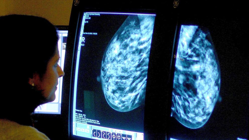 NHS ignored warnings on breast cancer screenings NHS ignored warnings on breast cancer screenings