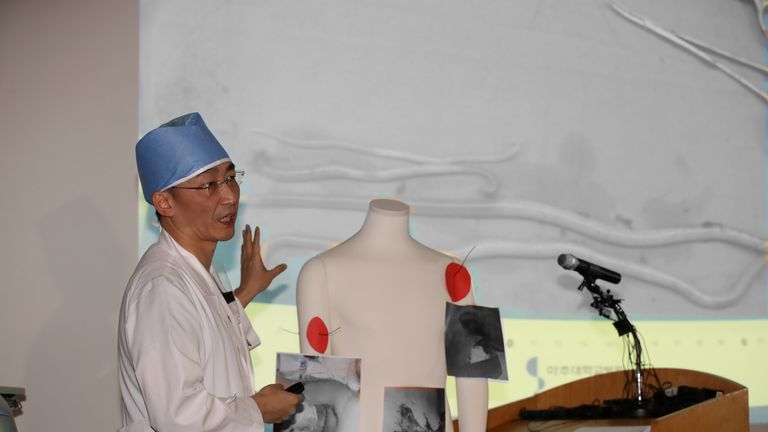 A surgeon Lee Cook-jong gives a briefing during a news conference at a hospital in Suwon, South Korea, November 15, 2017
