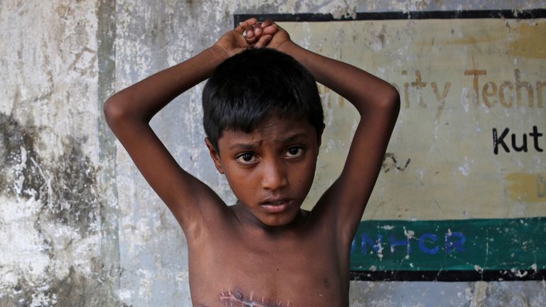 Mohammed Shoaib, 7, was shot in the chest in Myanmar