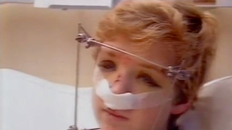 Stephen Ross, Enniskillen bombing survivor. Pic: UTV