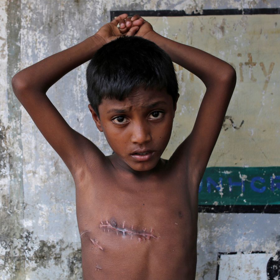 Mohammed Shoaib, 7, was shot in the chest in Myanmar