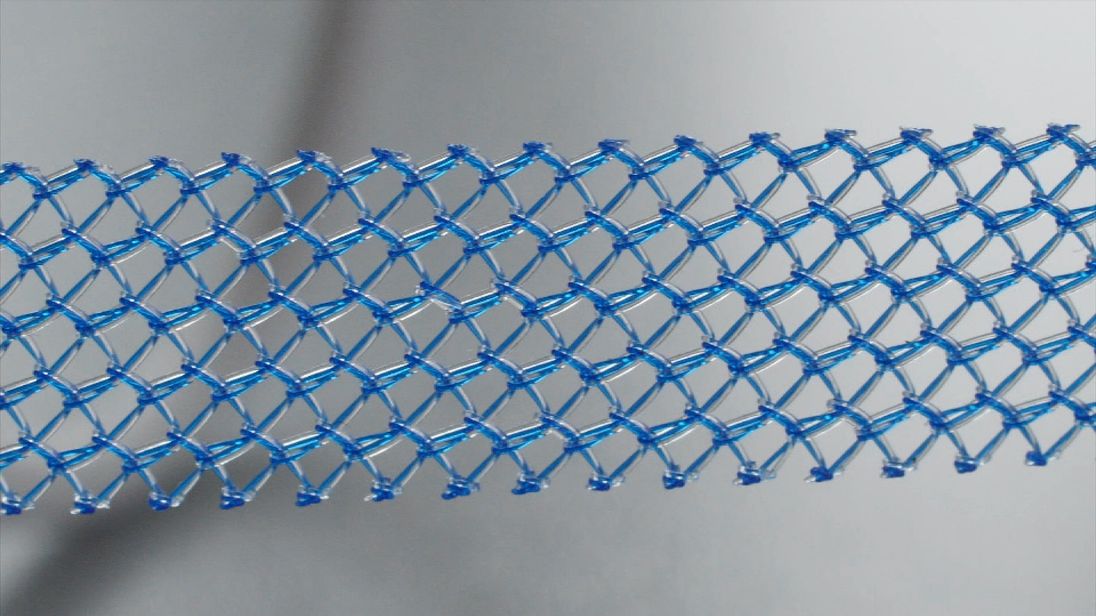 Thousands of women have reported complications as a result of mesh, including chronic pain, being unable to work or have sex