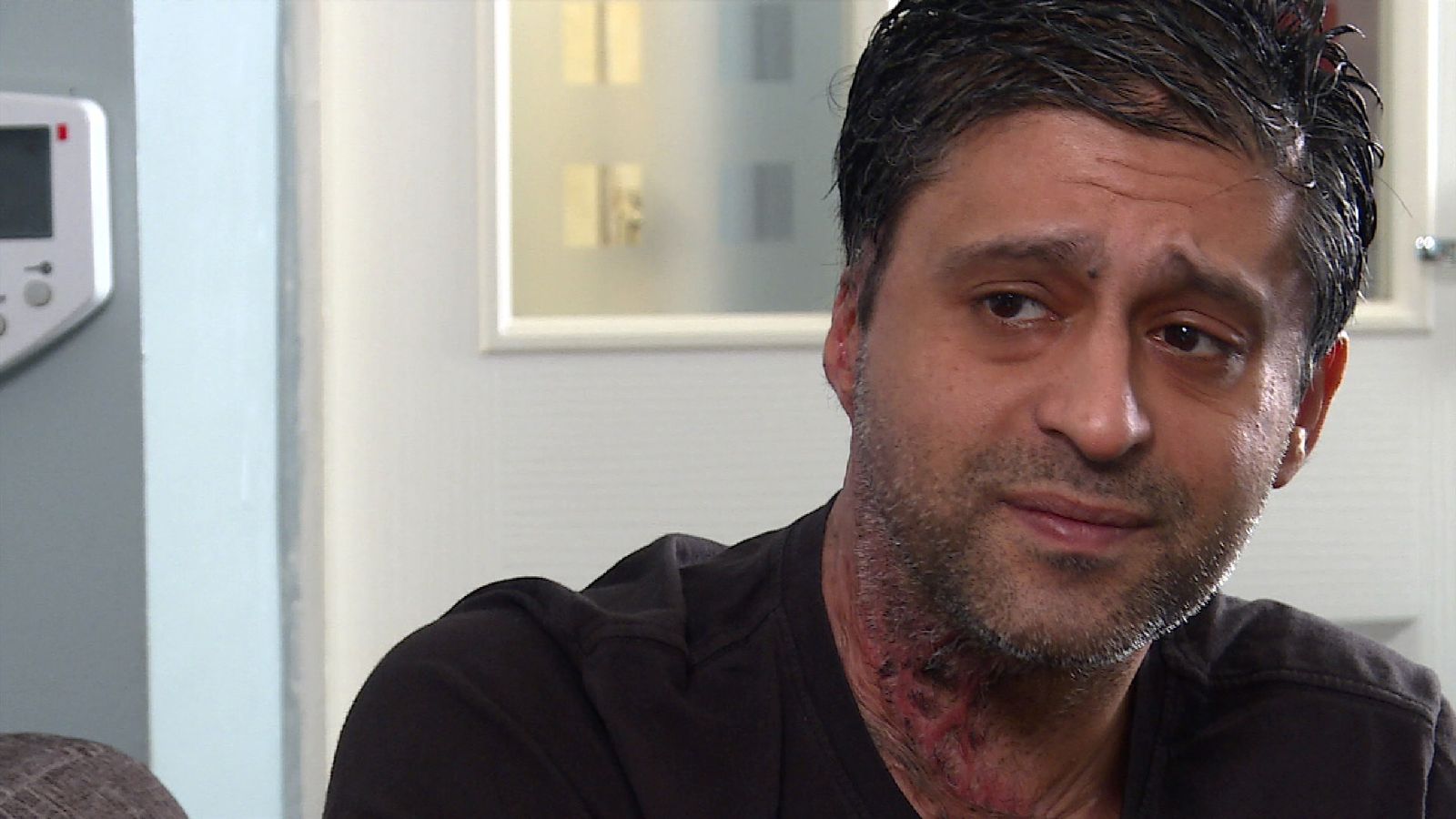 Acid victim 'feels sorry' for attacker John Tomlin as he awaits ...