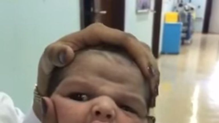The unidentified baby had been in hospital for 10 days with an infection