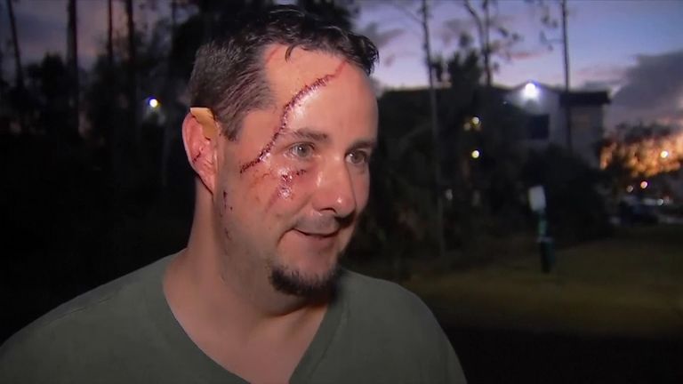 Andrew Meunier survived a bear attack. Pic: Wink News