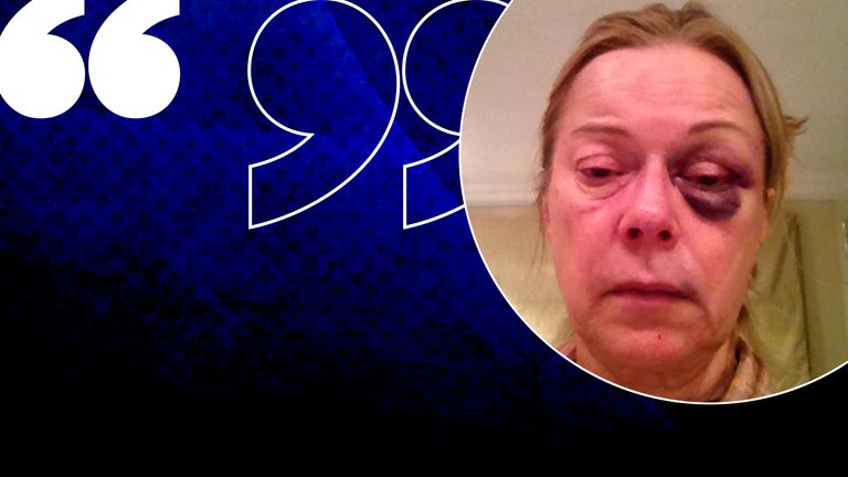 Susan Morris was attacked and robbed while alone in her Surrey home