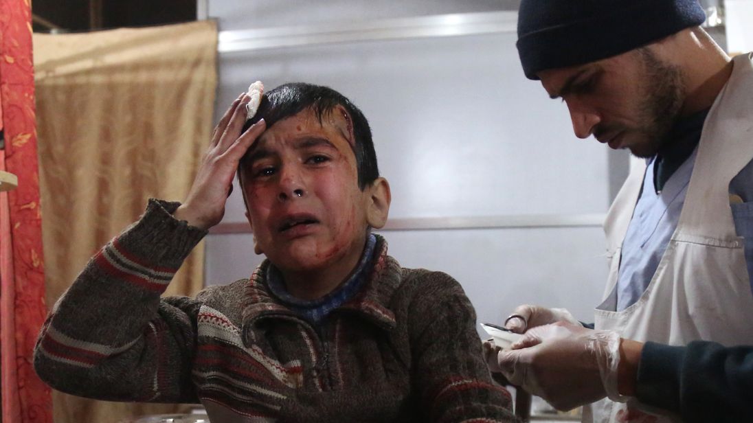 Ghaith, a wounded 12-year-old Syrian boy, cries as he receives treatment at a make-shift hospital in Kafr Batna and waits for news of his mother in the operating room