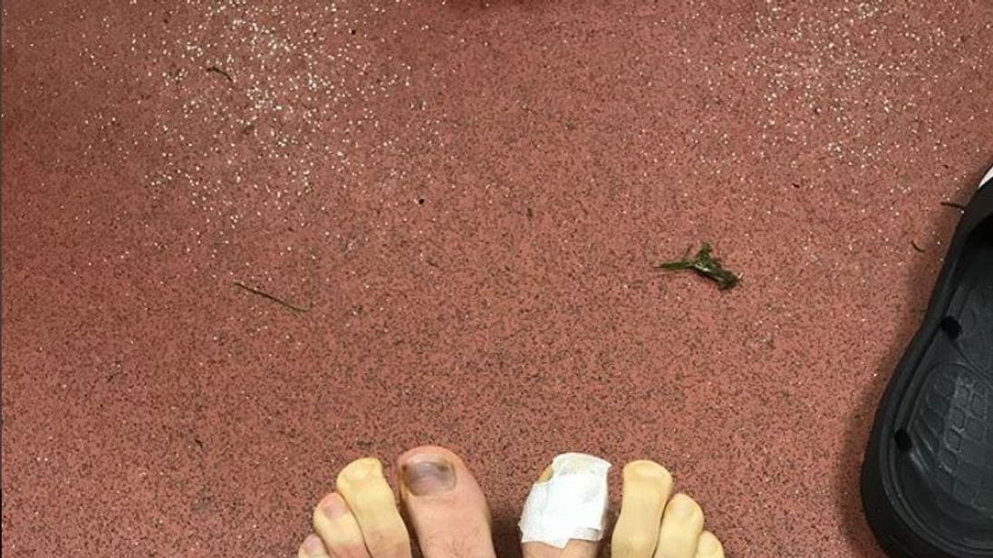 Adam Lallana&#39;s toes turned yellow in the freezing conditions