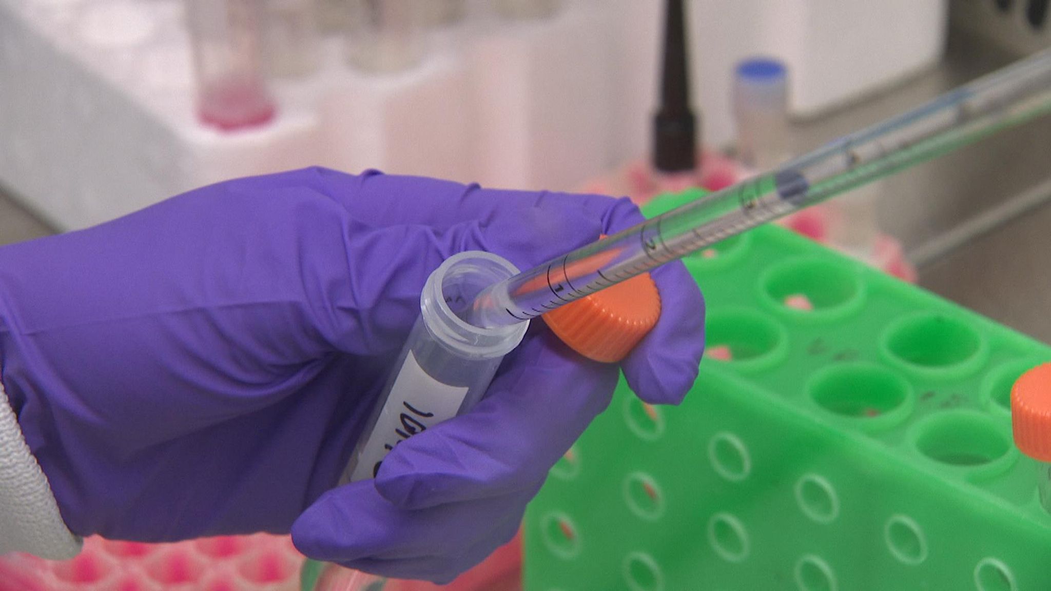 Likely cause of childhood leukaemia discovered in prevention ...