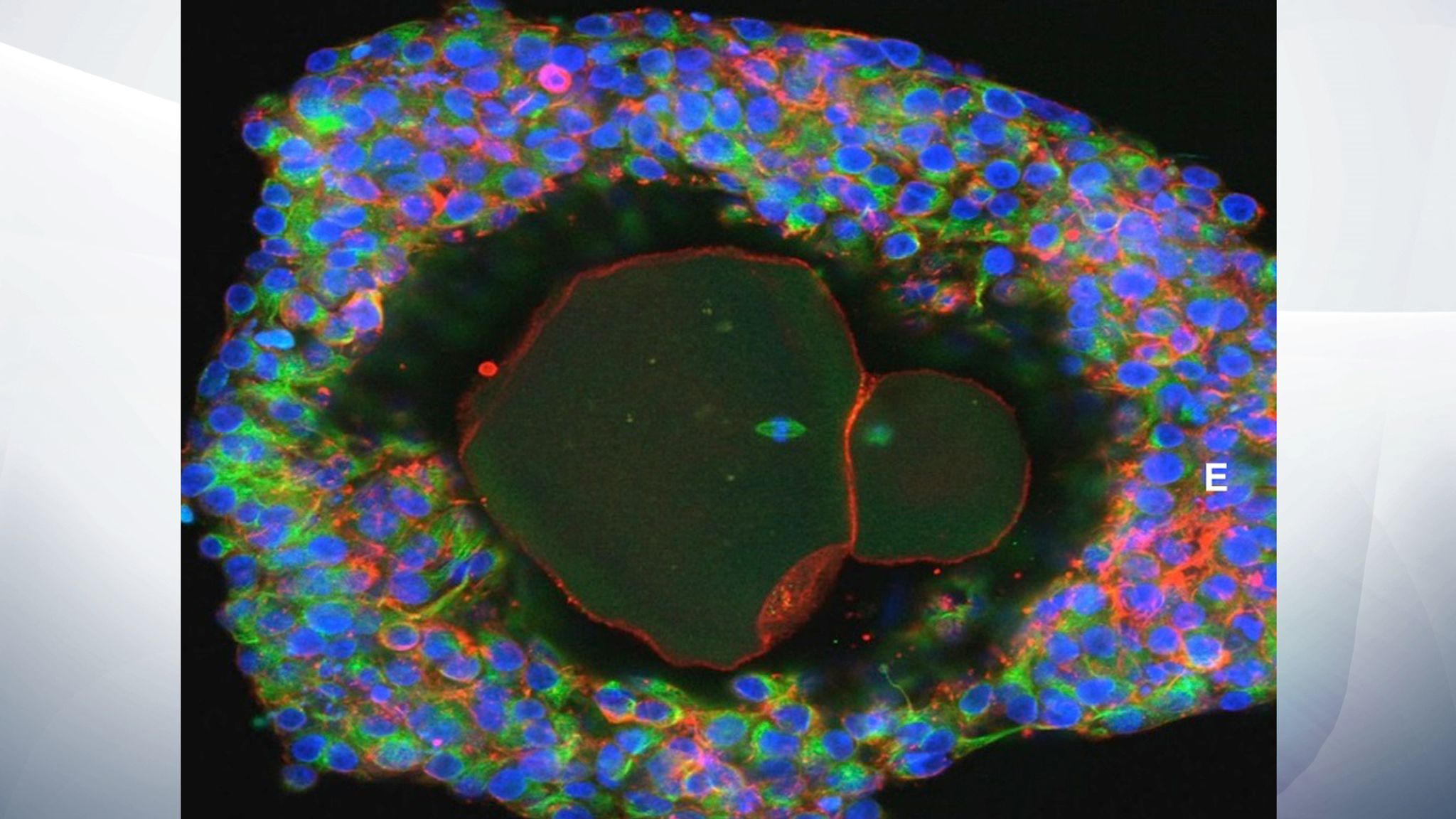 Human eggs fully grown in lab for first time ever Science & Tech News
