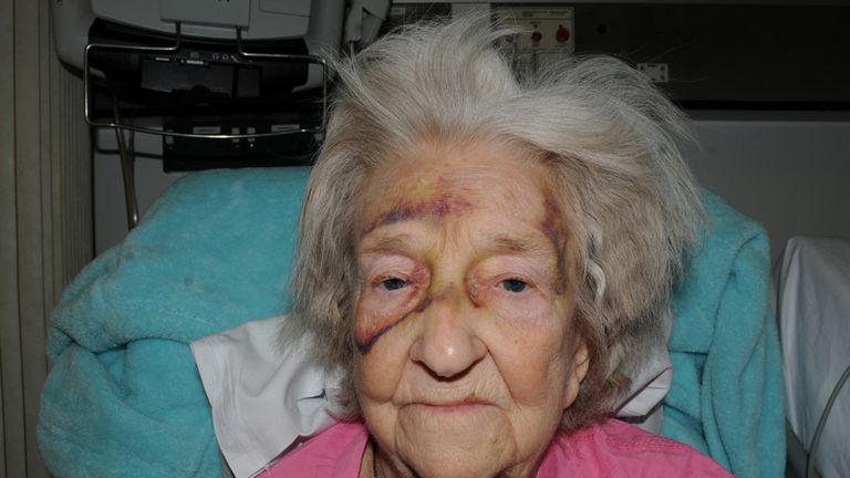 Eileen Blane spent two months in hospital but died the day after going home