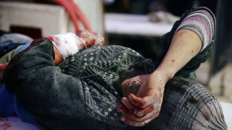  An injured man is seen at a medical point in the besieged town of Douma