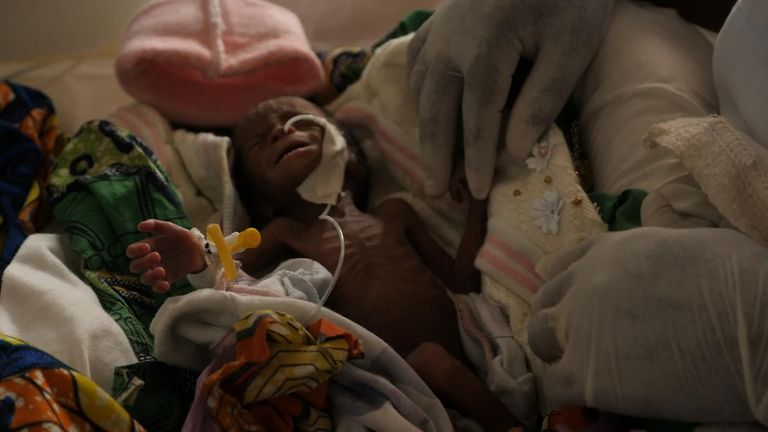 The baby is one of the Democratic Republic of Congo&#39;s &#39;internally displaced&#39;