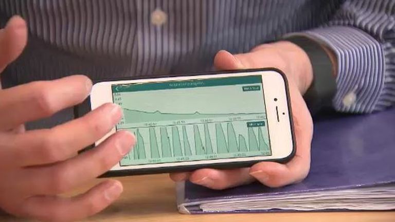Results from a wristband assessing an autism sufferer