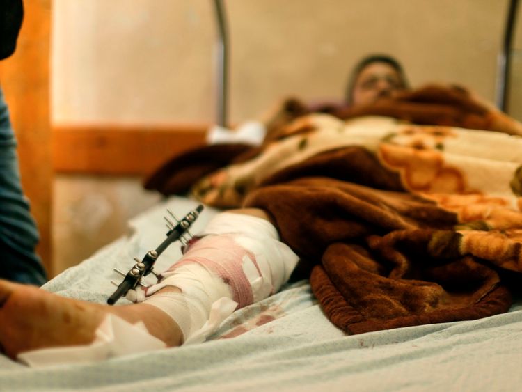 A Palestinian man wounded at the Israel-Gaza border is treated at the Shifa Hospital