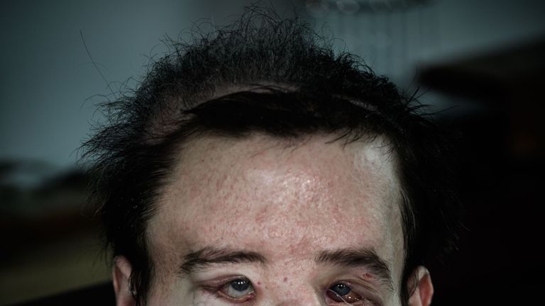 Jerome Hamon says he is '20 years younger'