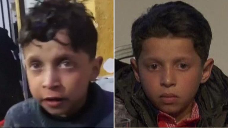 Hassan Diab after the attack (L) and at the OPCW news conference (R)