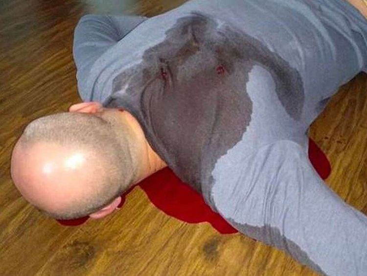 The image of Arkady Babchencko faked death, using pig's blood