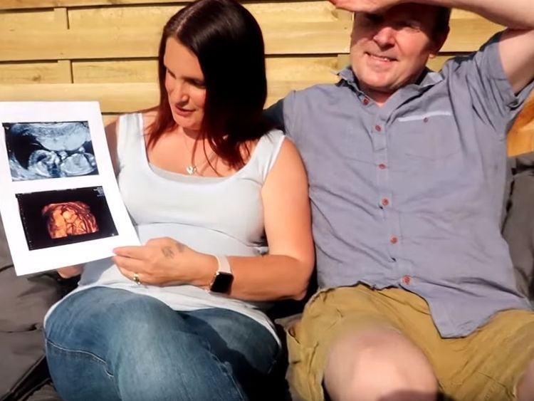 Sue and Noel Radford celebrate the news of a daughter due in November - their 21st child