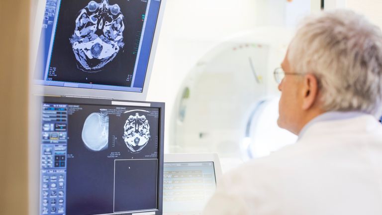 Rear view of doctor examining CAT scan reports - Stock image