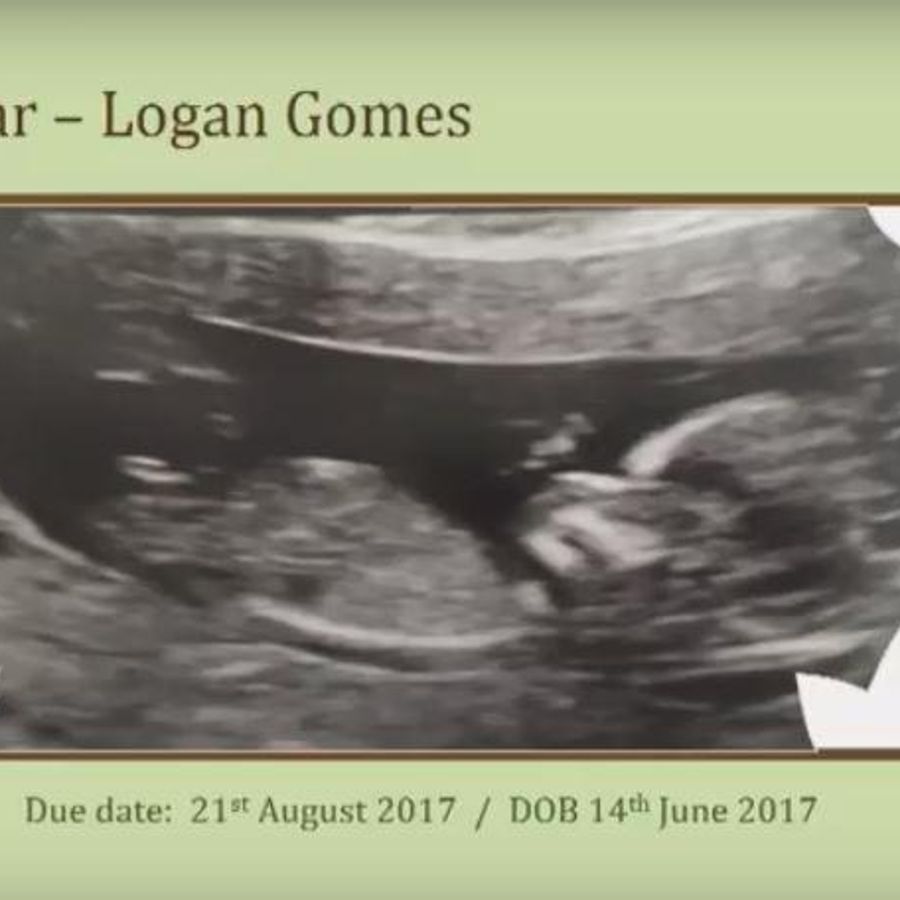 Logan Gomes
