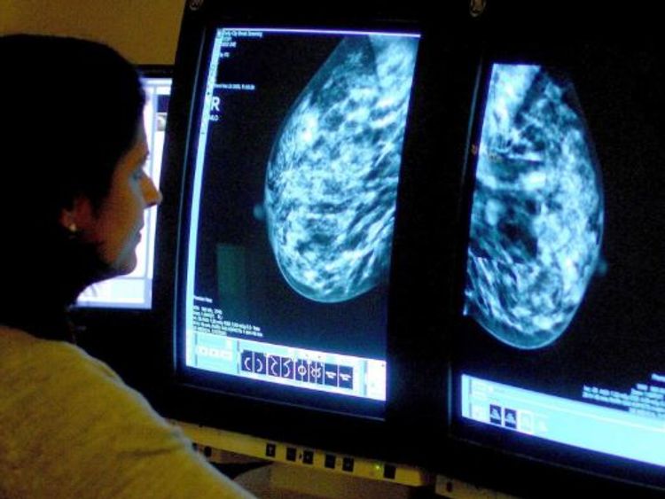 The study is thought to be the largest study ever done on breast cancer treatment.