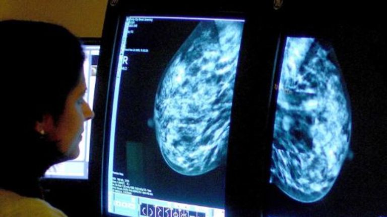 The study is thought to be the largest breast cancer treatment trial ever