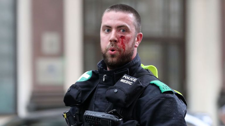 A police medic sports a facial injury after protesters scuffle with police at the junction during a gathering by supporters of far-right spokesman Tommy Robinson in central London on June 9, 2018, following the jailing of Tommy Robinson for contempt of court. (Photo by Daniel LEAL-OLIVAS / AFP) (Photo credit should read DANIEL LEAL-OLIVAS/AFP/Getty Images)
