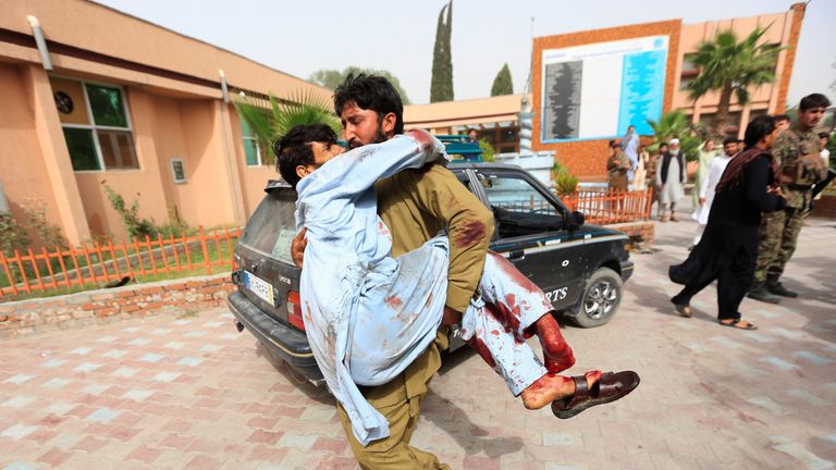 An injured man is carried to a hospital after a car bomb in Jalalabad city