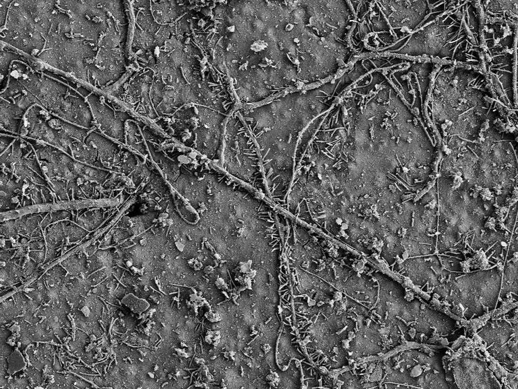 Plastic-eating microbes could help environment Plastic-eating microbes could help environment