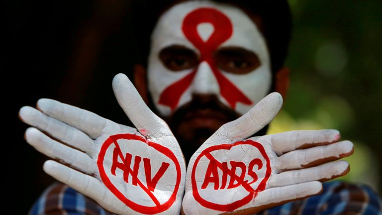 The UN has warned the fight against AIDS is being stalled by complacency