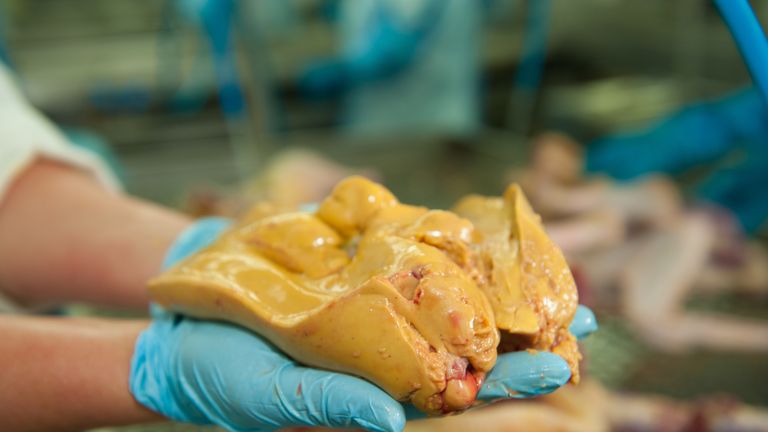 Foie gras