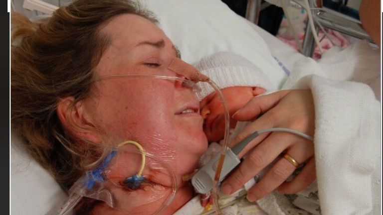 #myNHSstory 11 years ago I suffered an amniotic fluid embolism after the birth of my 4th child. I needed 28 units of blood. I am grateful every day to the wonderful staff and amazing blood donors who saved my life #giveblood