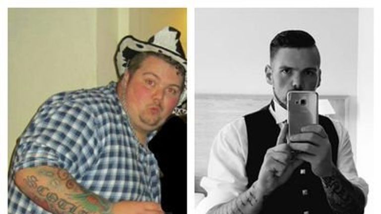 #myNHSstory #obesity #obsmuk #NHS70 #skynews I had a gastric bypass through the NHS and it has saved my life, the staff where amazing from my gp, dietician, the surgeon and the staff on the ward. I've gone from 30st to 14st and quality of life is amazing now. Thank you #NHS
