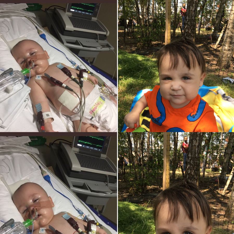 Without our NHS Ethan would have died because of chronic lung disease, pneumonia, heart failure, renal failure. Instead he just had a new kidney from an altruistic donor and will live a full and normal life. #NHS70⁠ ⁠@GreatOrmondSt #myNHSstory
