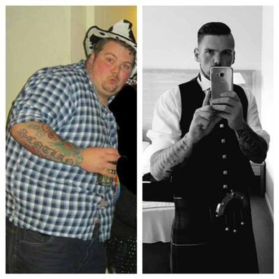 #myNHSstory #obesity #obsmuk #NHS70 #skynews I had a gastric bypass through the NHS and it has saved my life, the staff where amazing from my gp, dietician, the surgeon and the staff on the ward. I've gone from 30st to 14st and quality of life is amazing now. Thank you #NHS
