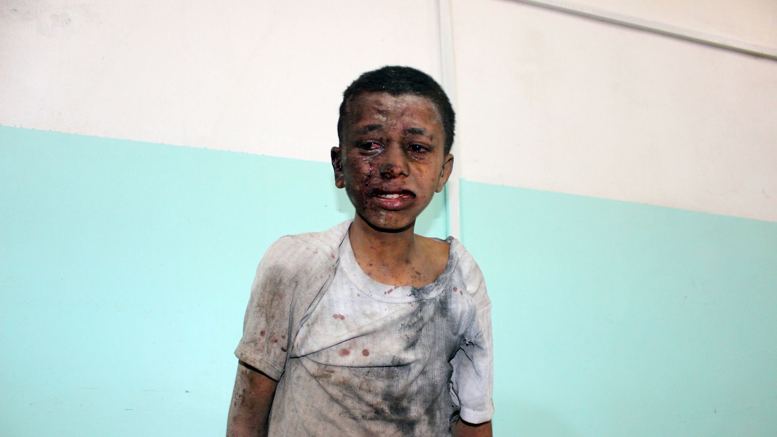 Airstrike on children's bus is 'a low point' in Yemen war - UNICEF