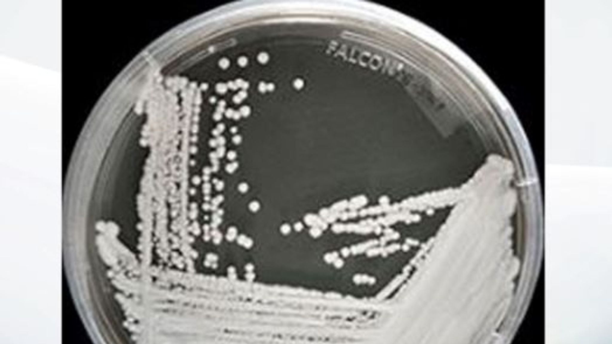 Australia State Records First Case Of Candida Auris Fungus That May Have Come From Uk World 