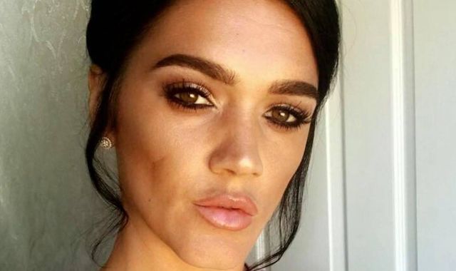 Leah Cambridge inquest: Mum of three 'may not have been aware' of 'bum lift' risks