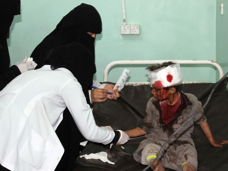 A number of children died and were injured following an air strike in Yemen