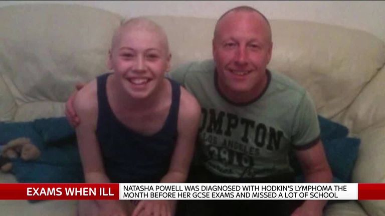 Hodkin&#39;s Lymphoma patient completed GCSEs
