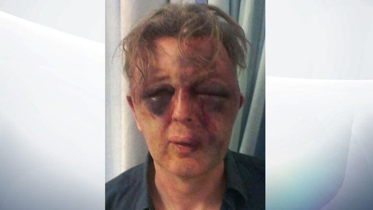 Paul Kohler was attacked at his home in Wimbledon, south London