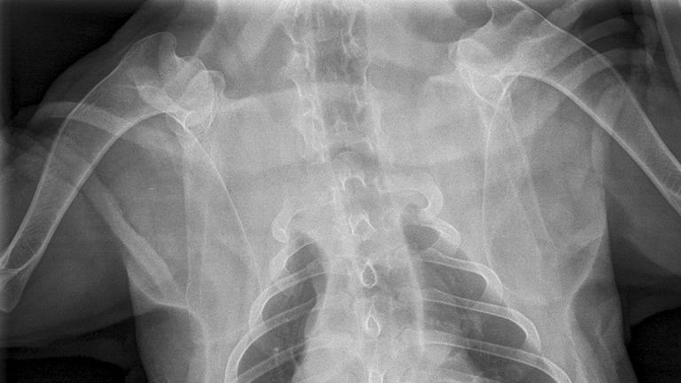  X-ray of a Sharpei dog called Hoshi which swallowed an eight-inch metal skewer 